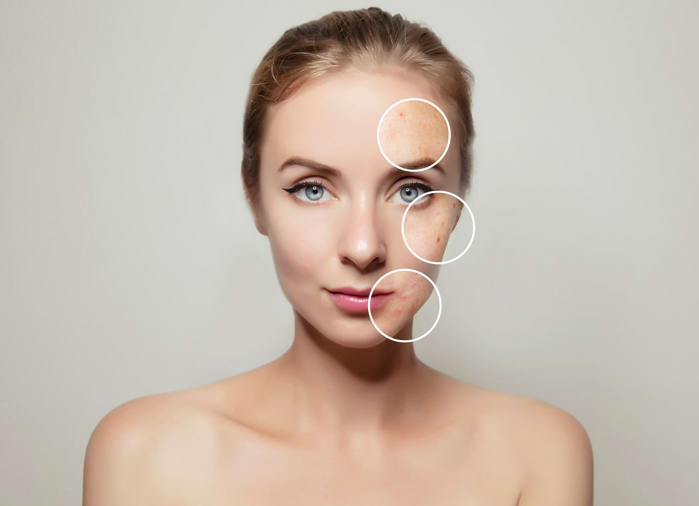 soluție anti-îmbătrânire de la dermatologie pentru îngrijirea pielii riduri fine sub ochi