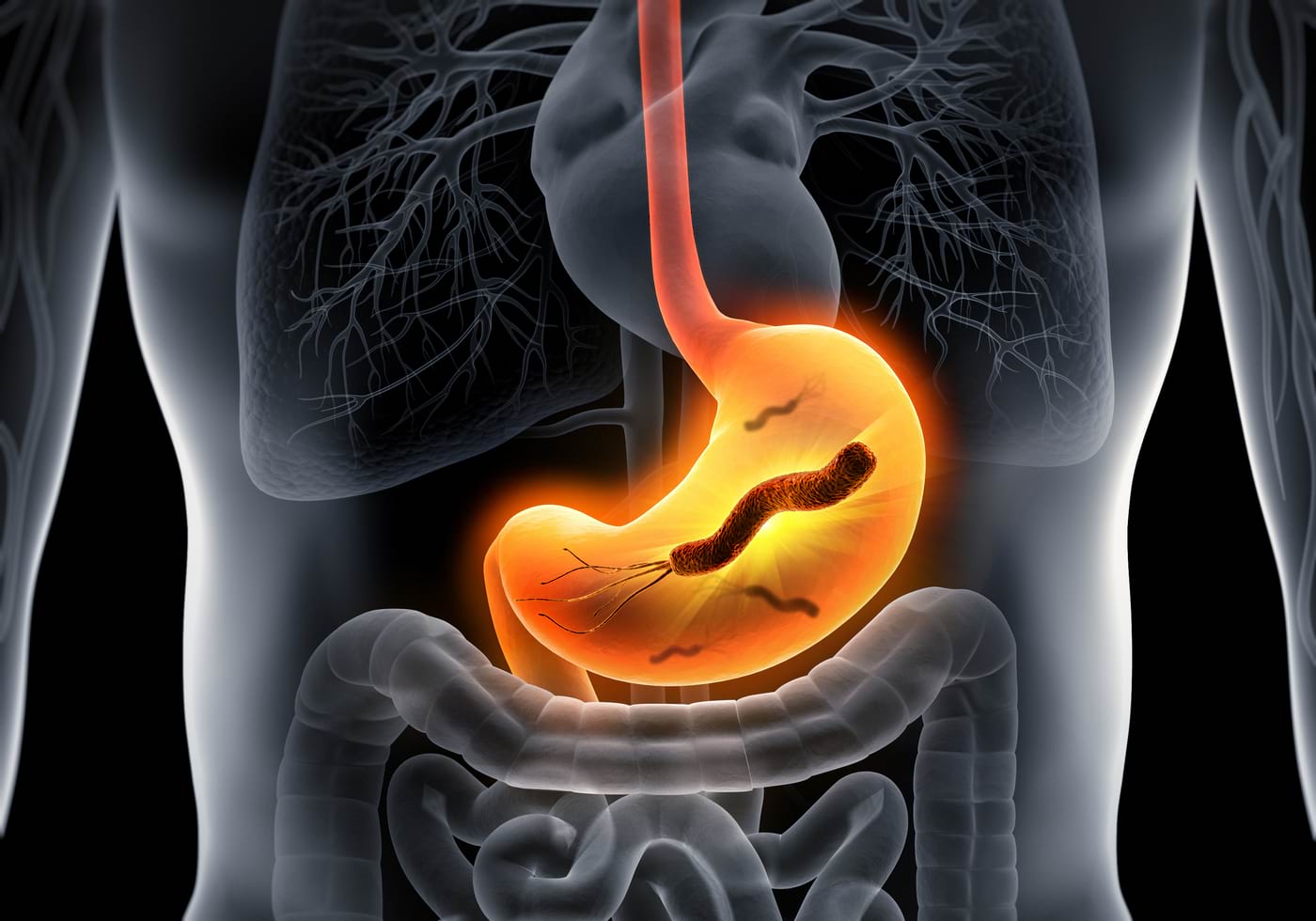 Scăderea în greutate din ulcerele de stomac (medicamente, stomac, tiroidă)