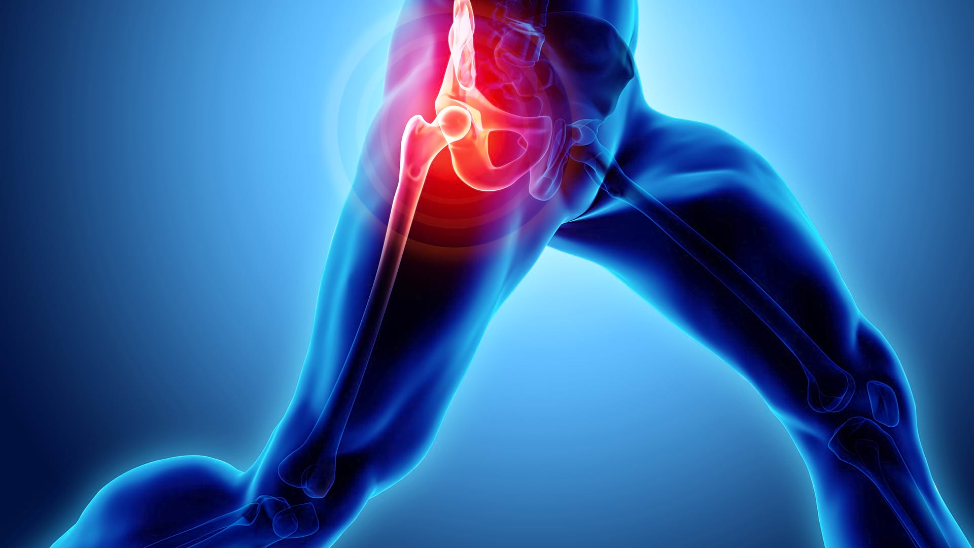 Durerea de genunchi : Cauze, factori predispozanti, tratament