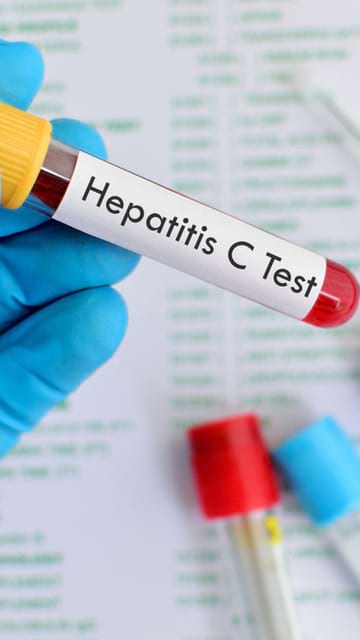 Hepatita C, o boala periculoasa, dar care poate fi tratata eficient