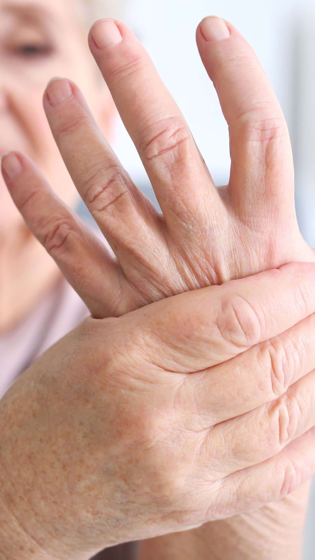 Ce este Artrita : Cauze, simptome si tratament | Bioclinica