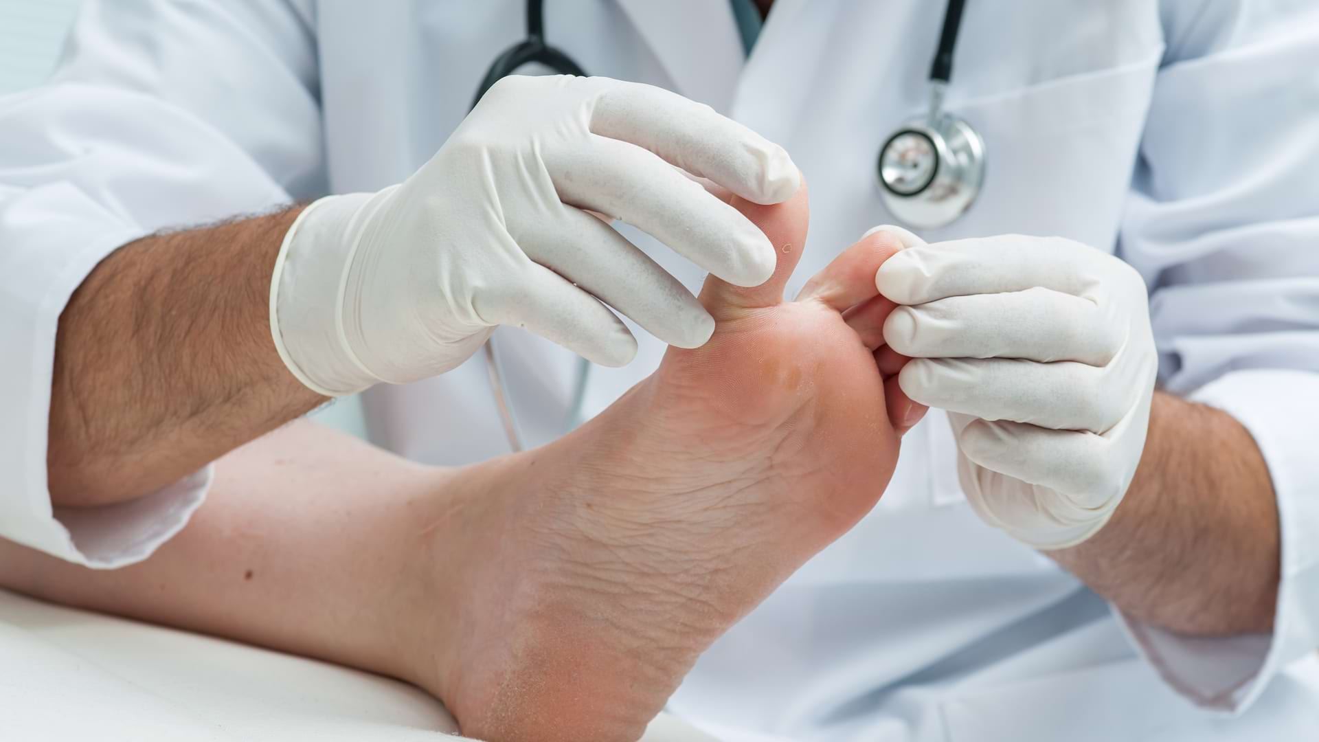 Cum să tratezi un deget de la picior ce și cum să tratezi o ciupercă pe degetele de la picioare
