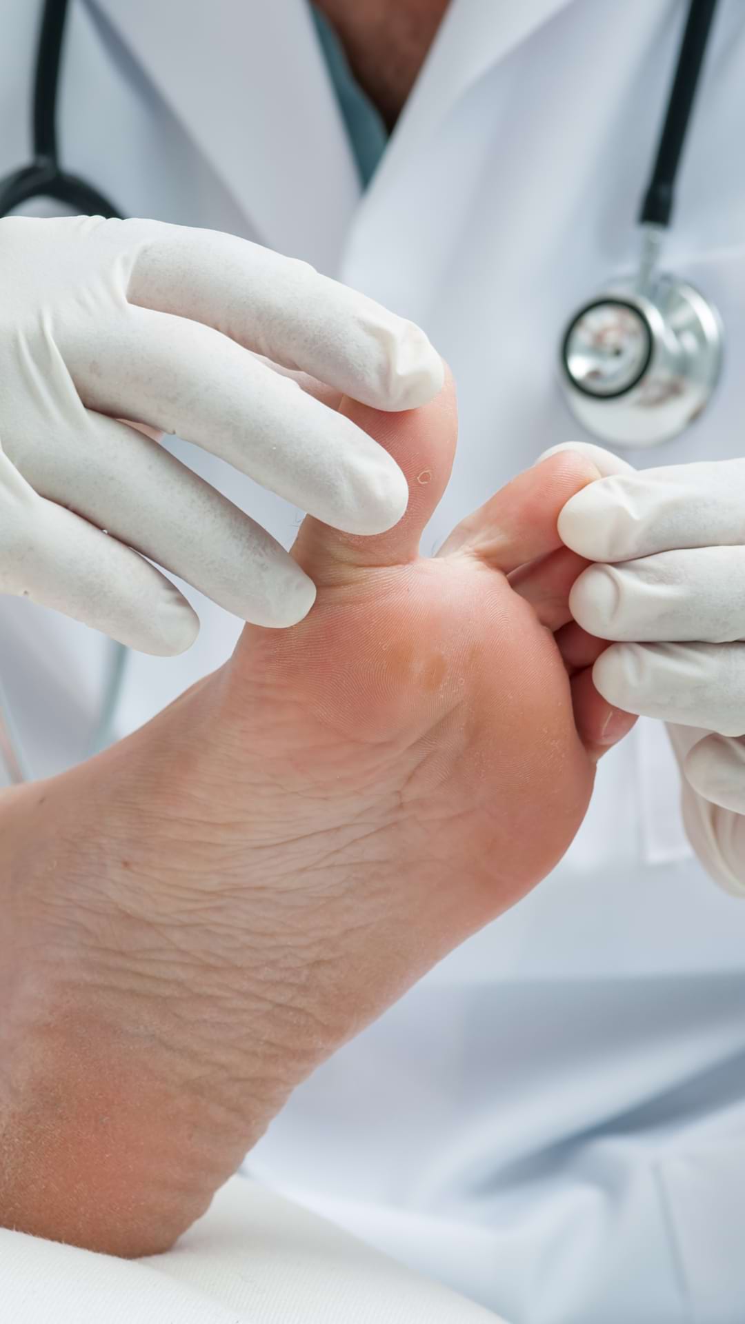 ciuperca psihosomatică a unghiilor de la picioare cât de des să curățați pantofii pentru ciuperca unghiilor