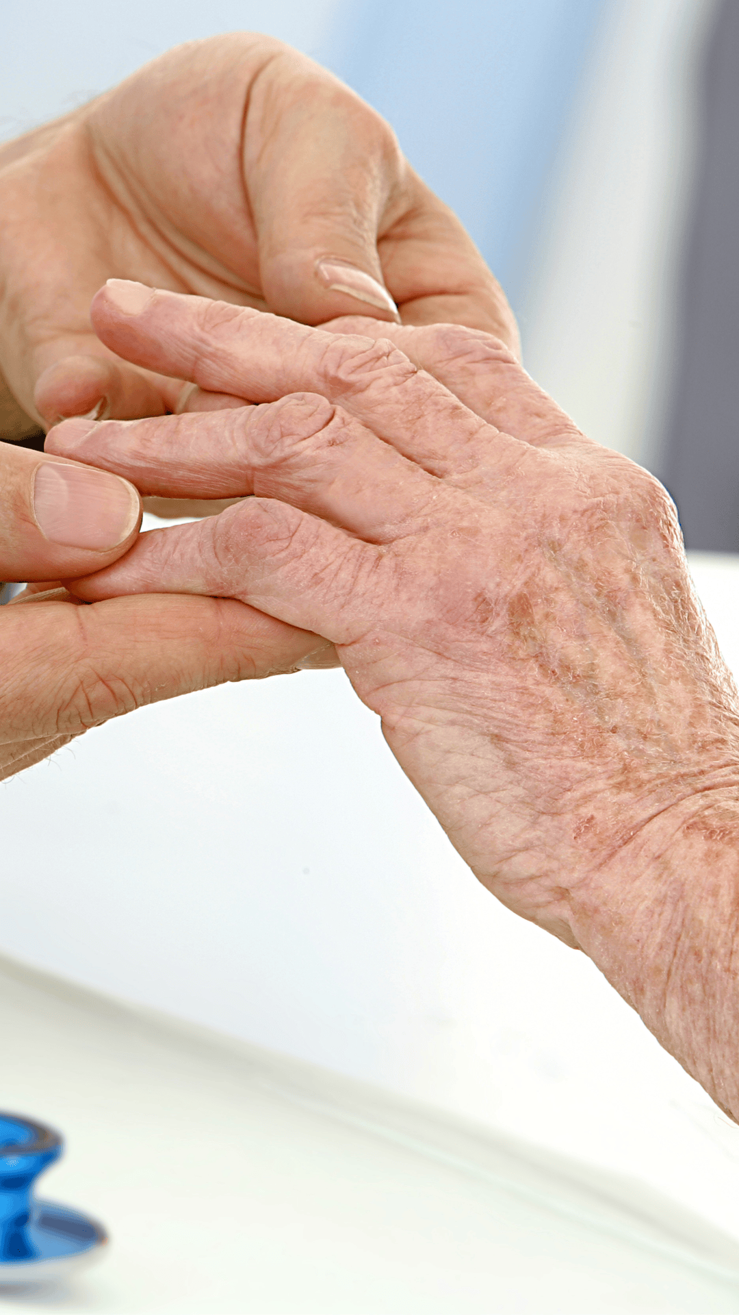 osteoartrita articulațiilor interfalangiene distale ale mâinilor