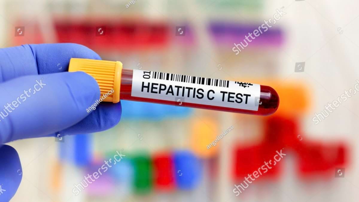 Hepatita C