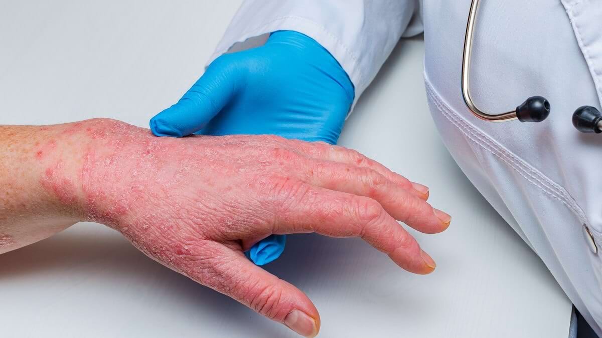 Simptome și diagnostic