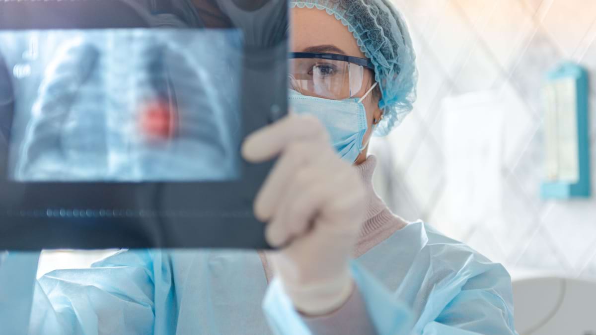 Cancer pulmonar