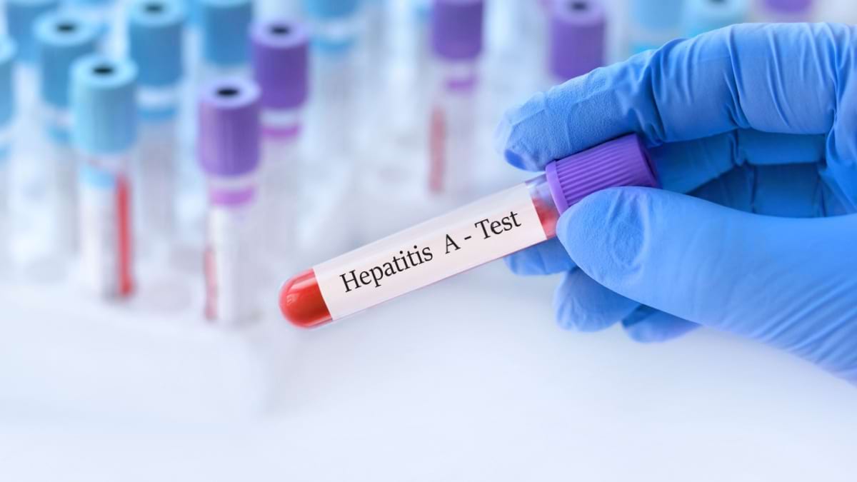 De ce esti VARA mai predispus infectarii cu virusul hepatic A