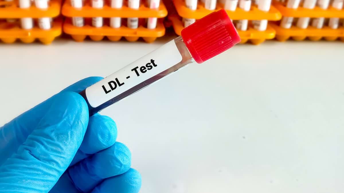 Categoriile de risc si atingerea "tintei" colesterolului LDL