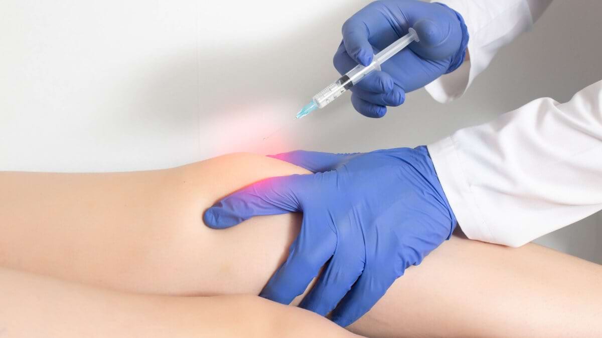 Cum influenteaza tratamentul cu sulfat de condroitină cartilajul articular?