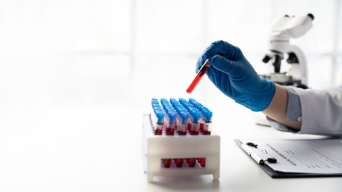 Hepatita B si meseriile care cresc riscul de infectare
