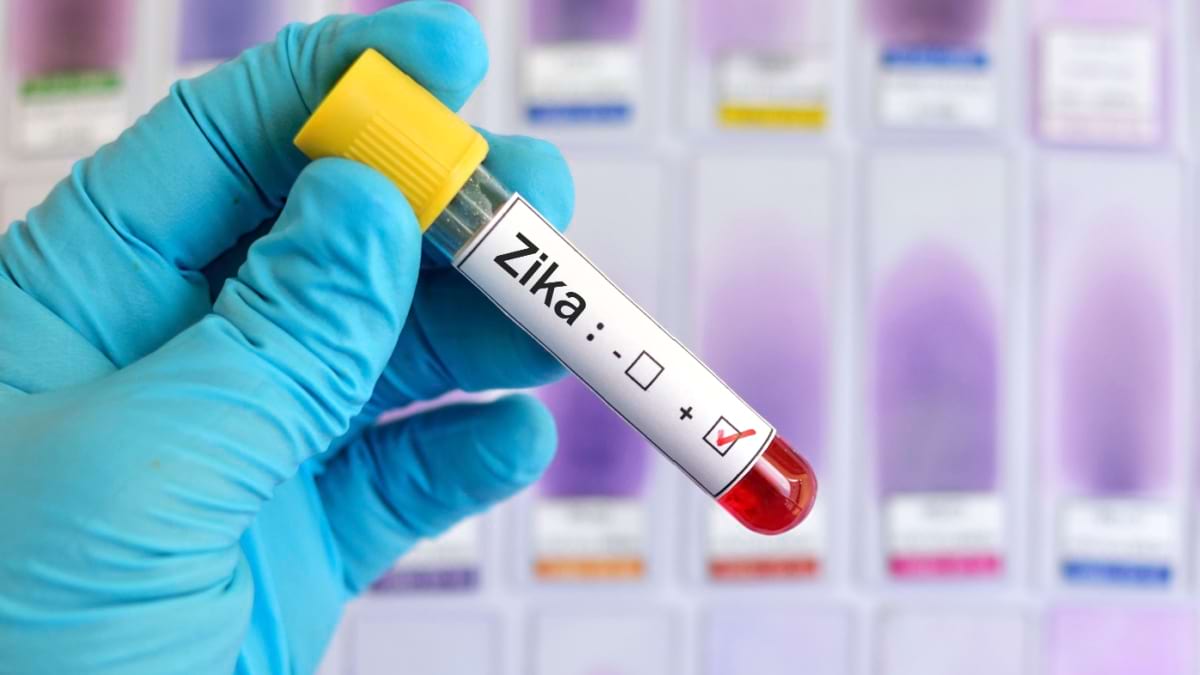 Virusul Zika: simptome, tratament, vaccin