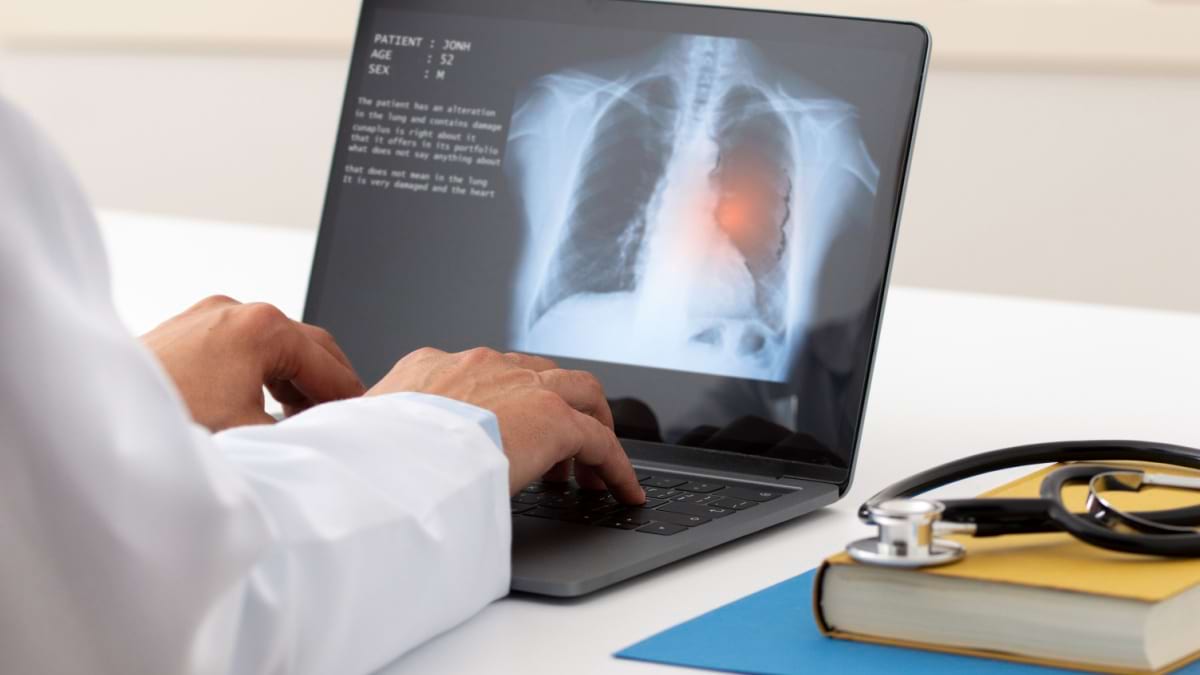 Efortul fizic la pacientii cu cancer pulmonar