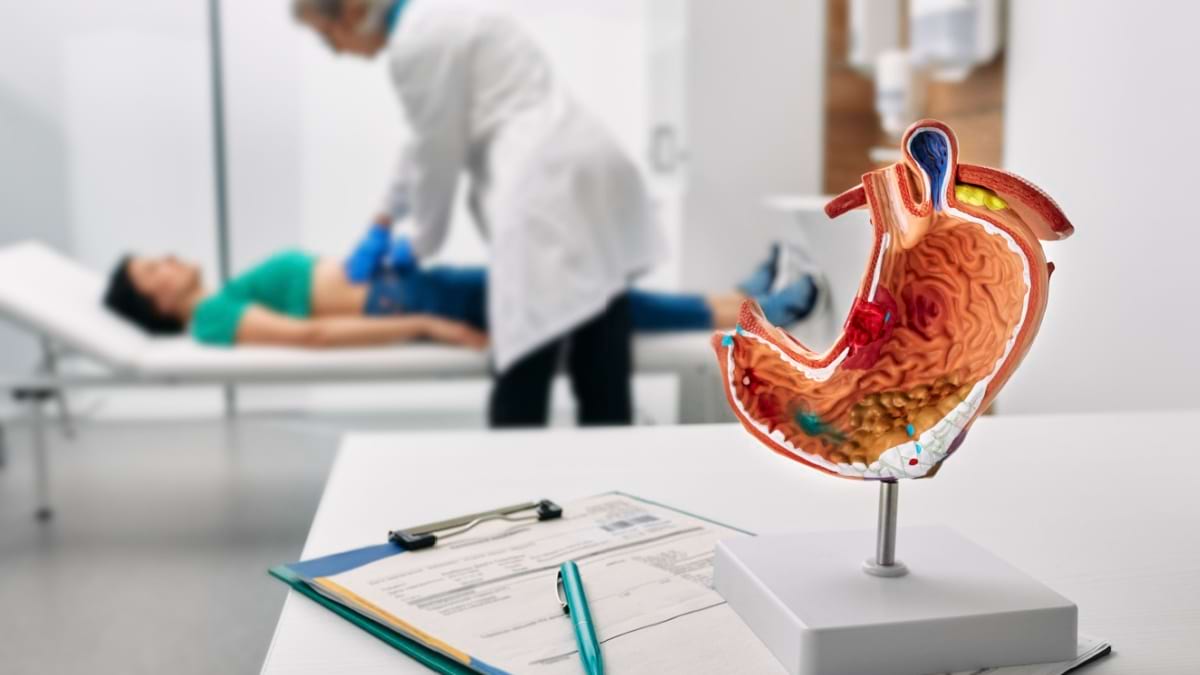 Cancerul gastric, o continua provocare