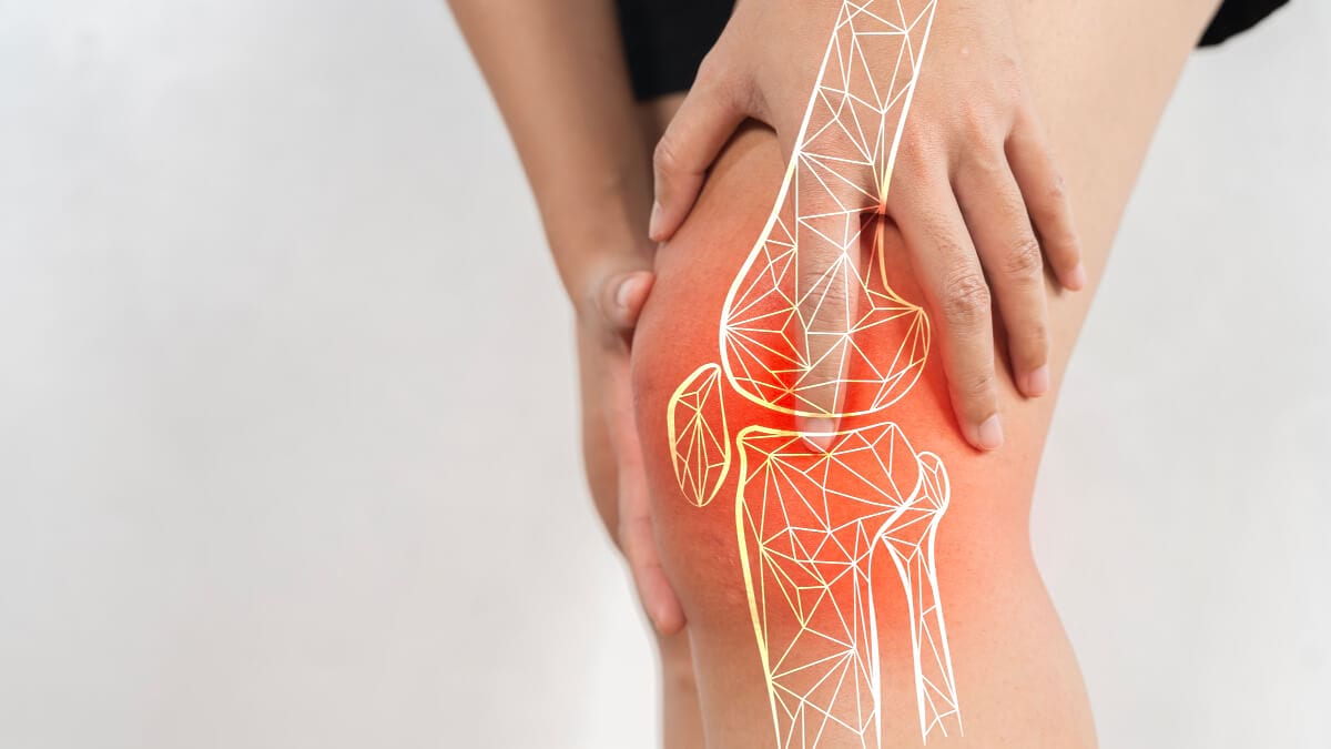 Proloterapia in tratamentul artrozei genunchiului