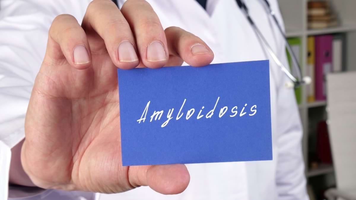 Amiloidoza: cauze, simptome și tratament