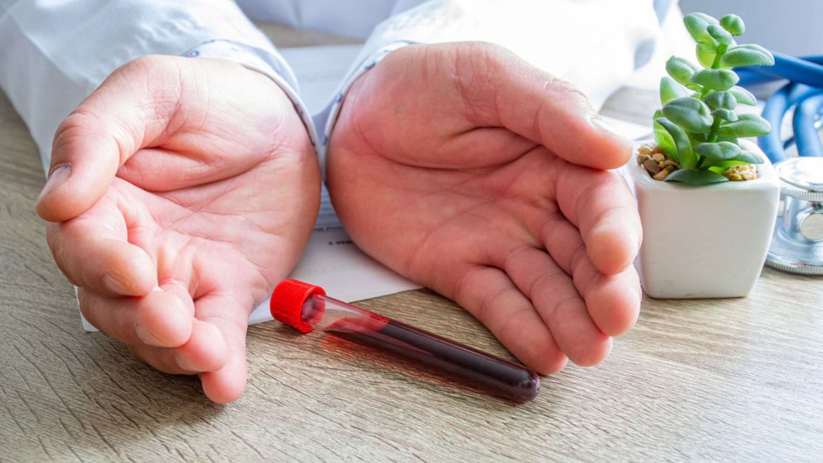 Cand ar trebui sa mergi la un medic hematolog?