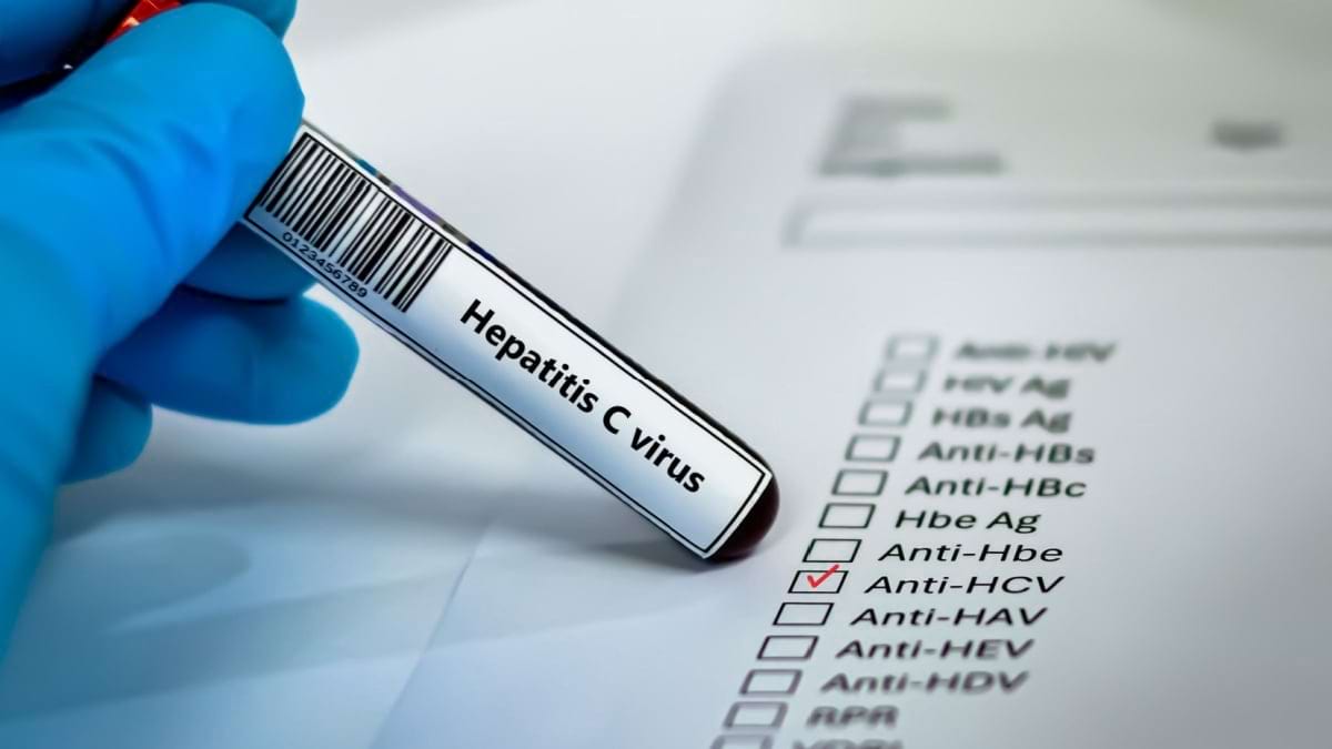 Diagnosticarea Hepatitei C