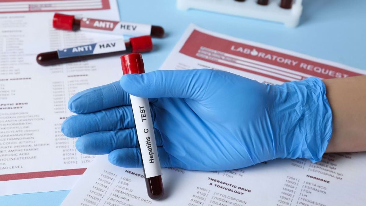 Hepatita C: genotiparea virusului hepatitic C