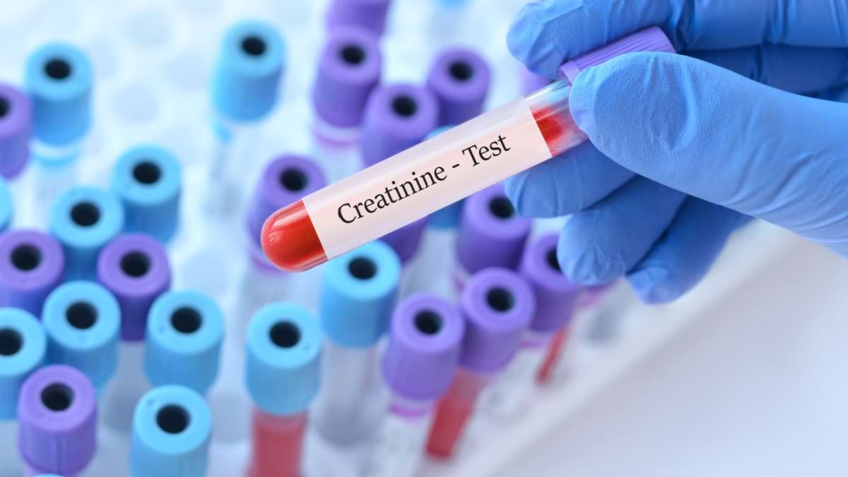 Totul despre creatinină: ce este, rol, valori normale