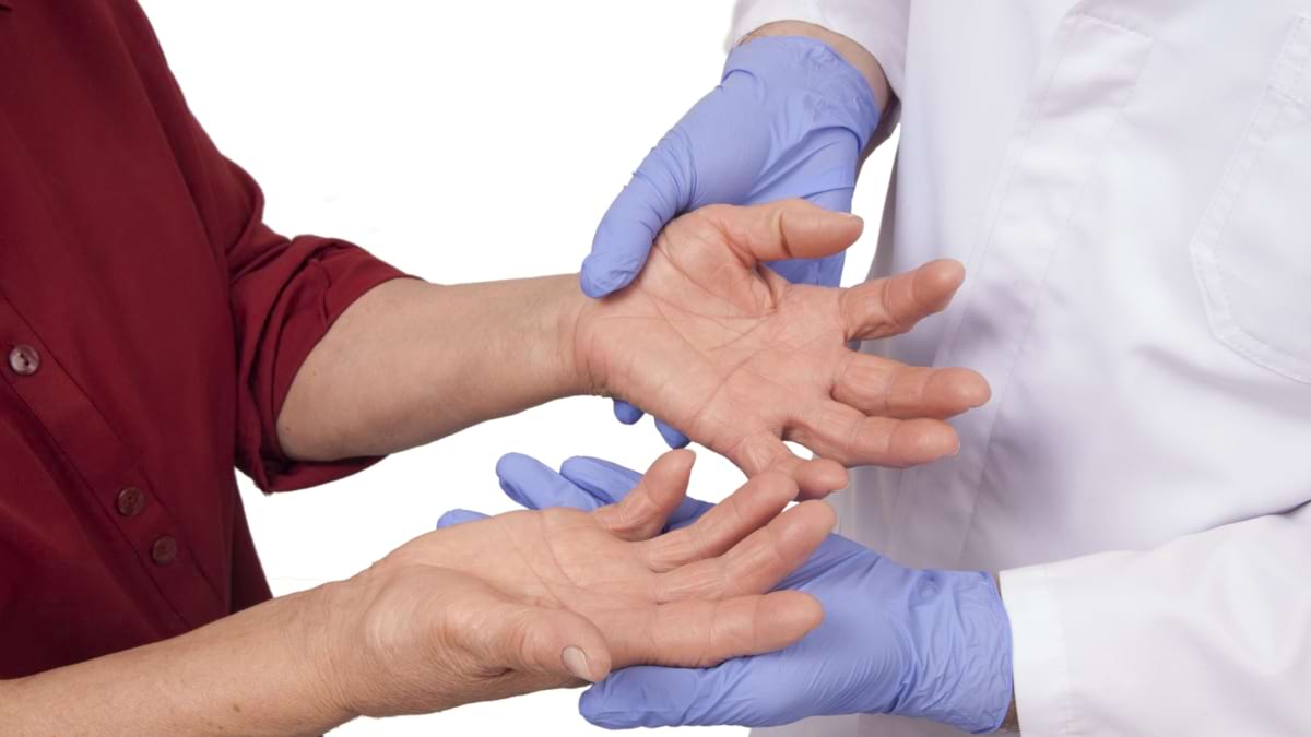 De ce este important diagnosticul precoce in poliartrita reumatoida?
