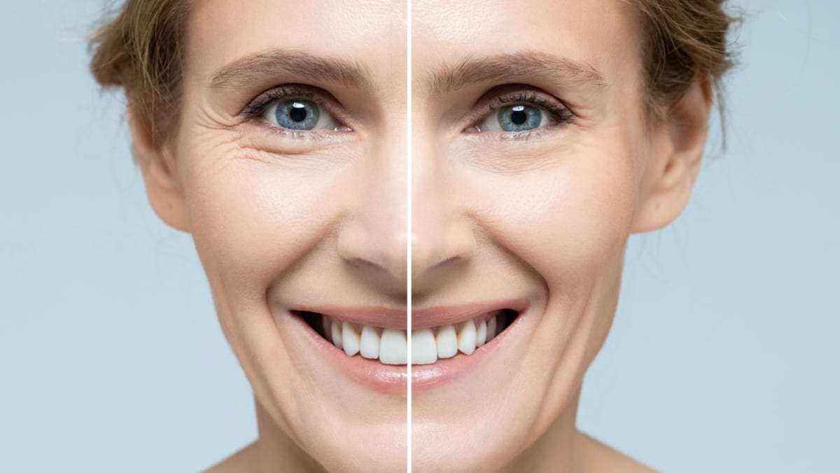 Ce impact are stresul oxidativ asupra procesului natural de îmbătrânire a pielii