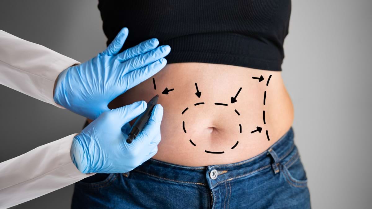Cele mai riscante proceduri cosmetice