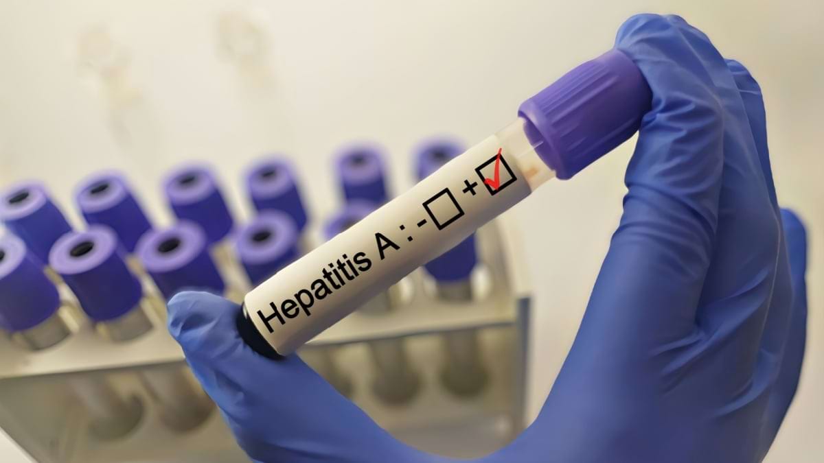 20 de lucruri importante de știut despre hepatita A