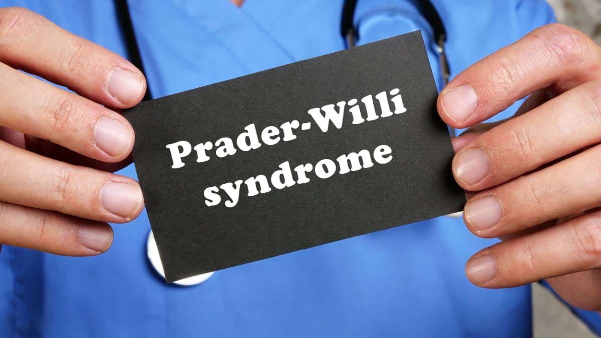 Totul despre sindromul Prader-Willi