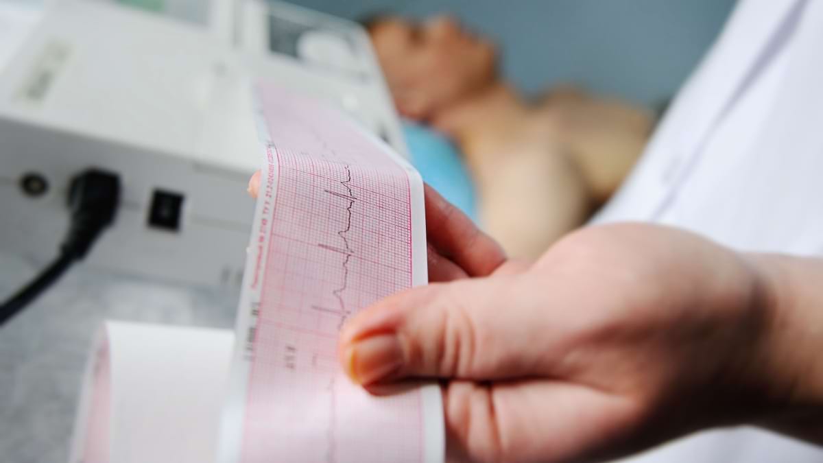 5 mituri despre accidentul vascular cerebral