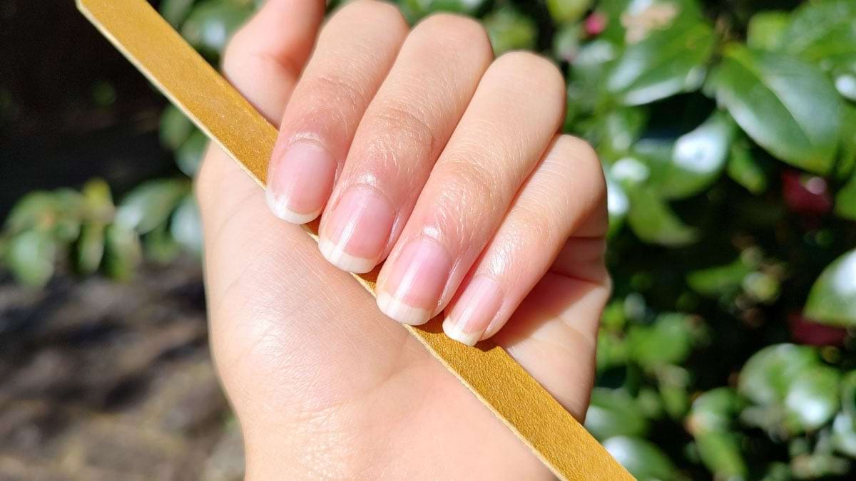 Modificările patologice ale unghiilor