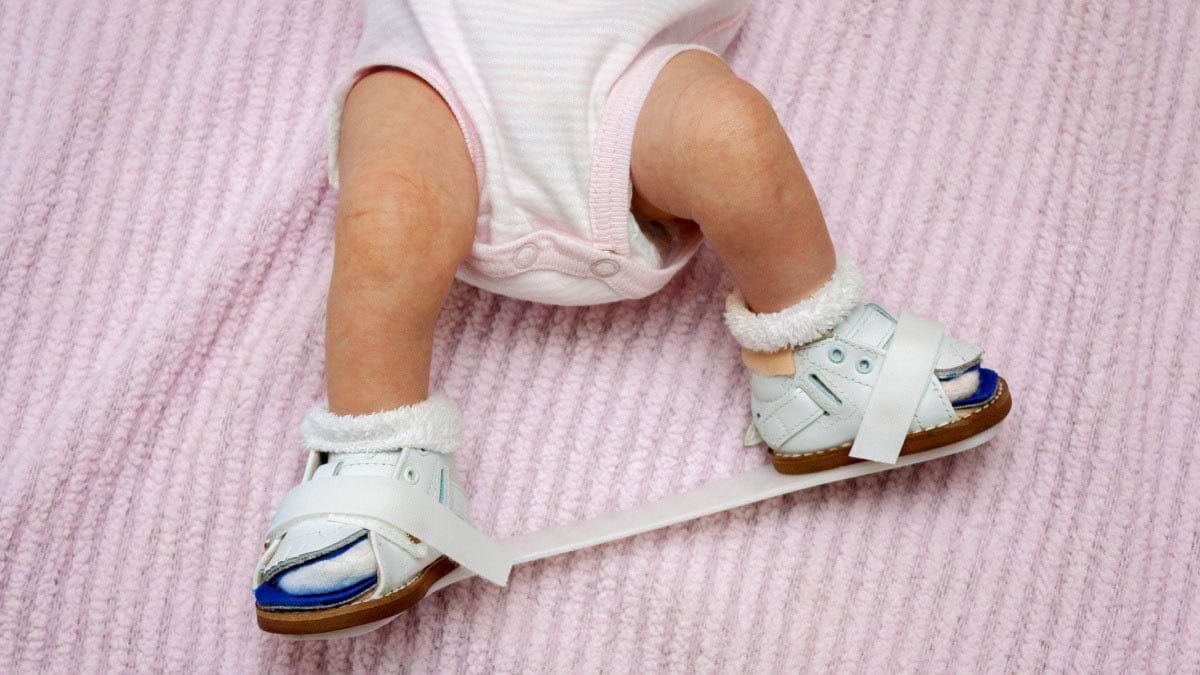 Pantofi ortopedici la bebeluși - când sunt cu adevărat necesari?