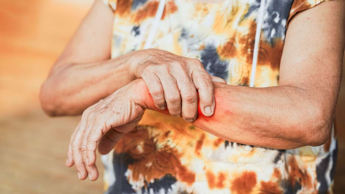 Cunoști pe cineva cu sclerodermie? Iată cu ce se confruntă, fizic și emoțional, și cum îl poți susține