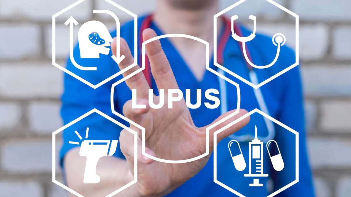 Tratamentele cu imunosupresoare si corticosteroizi in lupus: ce efecte au pe termen lung?