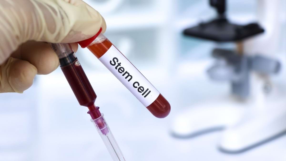 Tratamentul cu transplant de celule stem pentru limfom - beneficii și efecte secundare