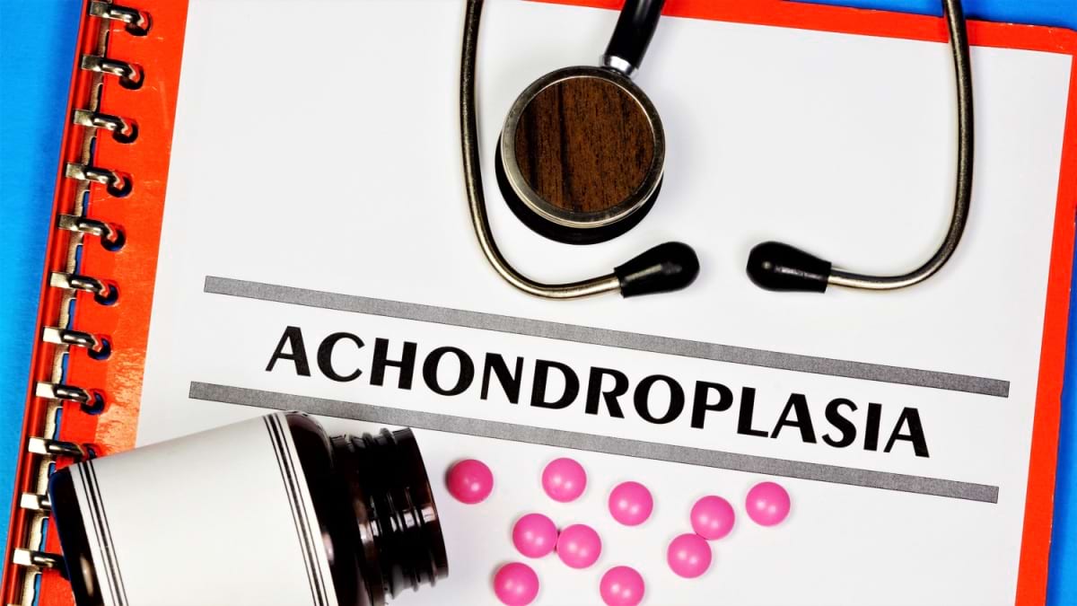 Acondroplazia: cauze, simptome, tratament