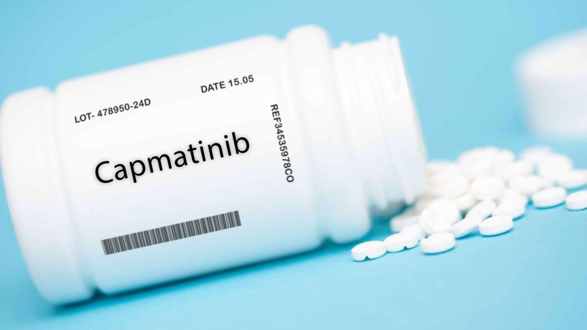 Cancerul pulmonar non-microcelular și tratamentul cu capmatinib