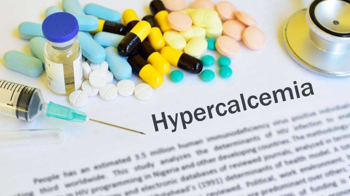 Hipercalcemia afecteaza pana la 30% dintre pacientii diagnosticati cu cancer