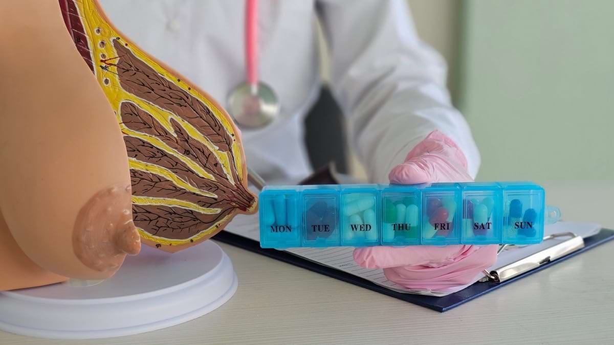 Opțiuni de tratament în cancerul mamar avansat – alpelisib