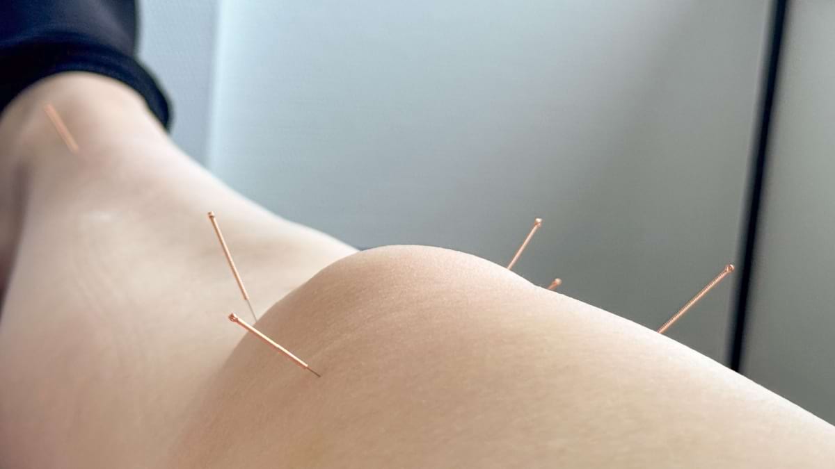 Acupunctura ajuta in durerea cronica de genunchi?