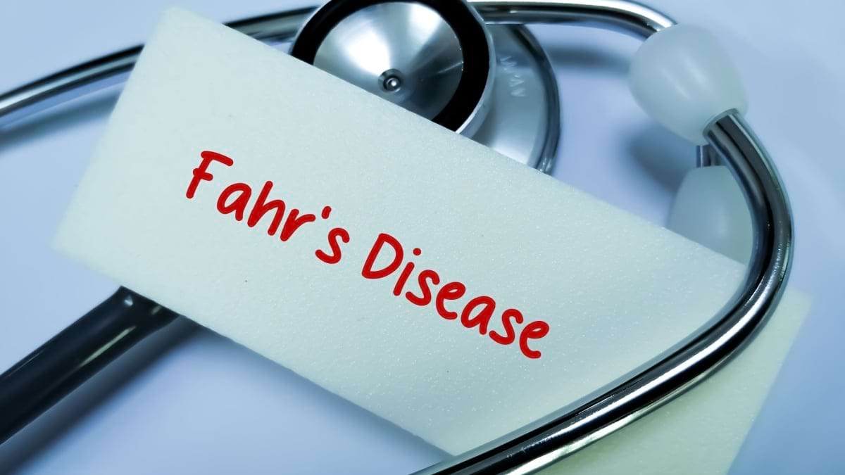 Boala Fahr (sindromul Fahr): cauze, simptome, tratament