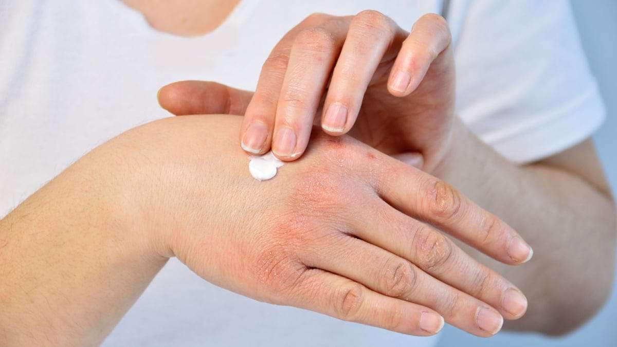 Cum ne protejam pielea de frig in sezonul rece?