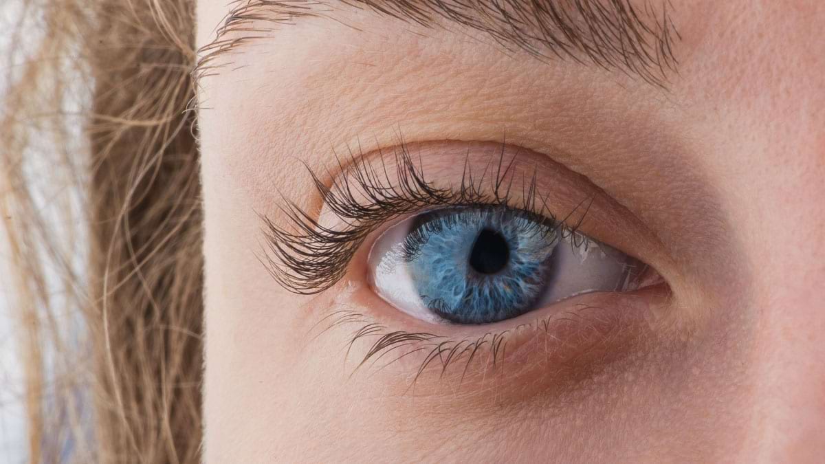 Melanomul malign ocular, mai frecvent la persoanele cu ochi de culoare deschisa