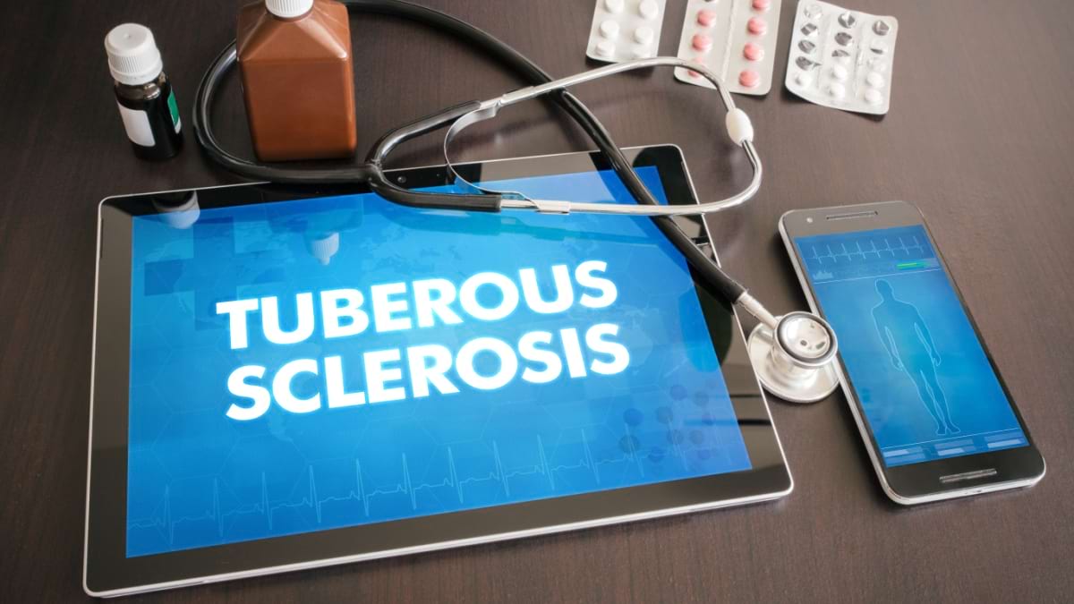 Scleroza tuberoasă: cauze, manifestări, tratament
