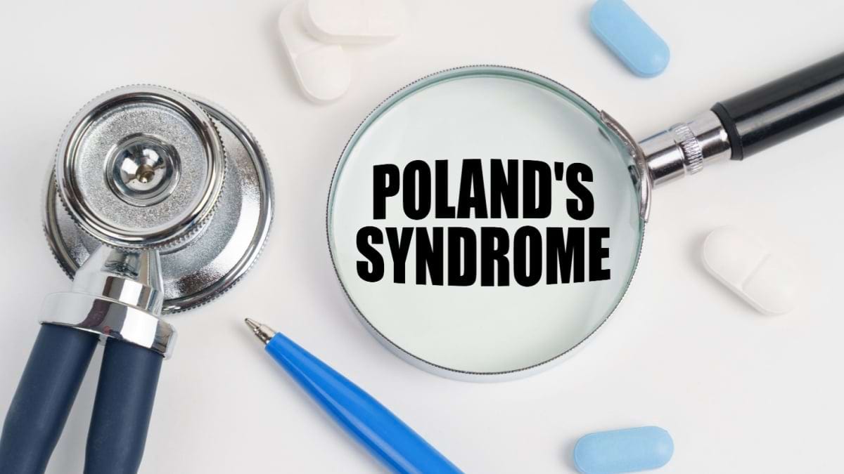 Sindromul Poland: cauze, simptome, tratament