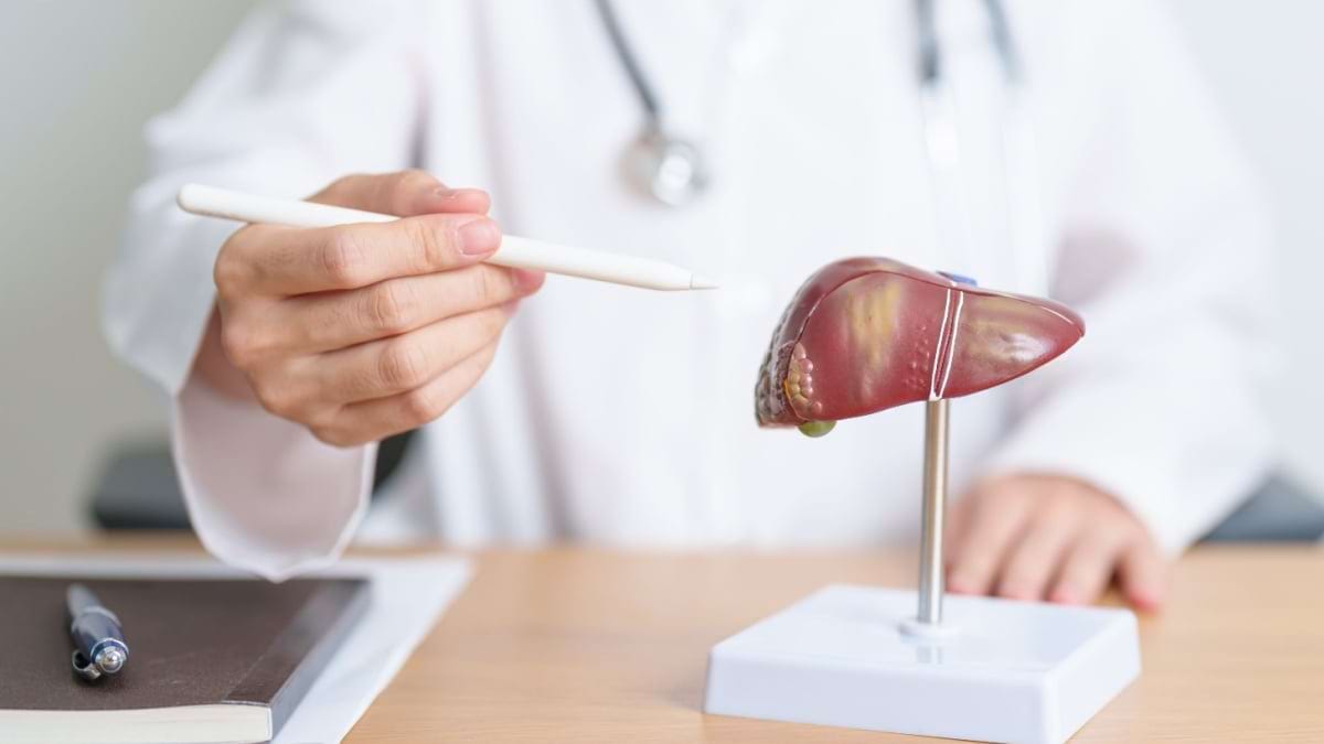 Hepatita C și grad de fibroză 2, 3 și 4