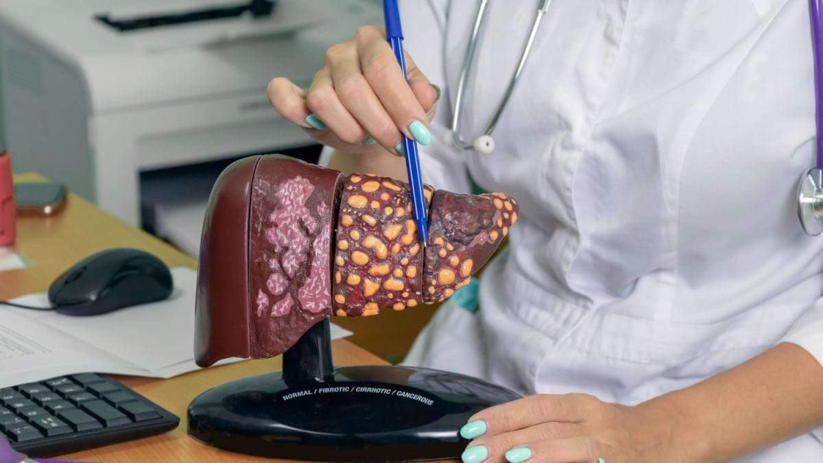 Totul despre cancerul hepatic – cauze, tipuri, simptome și prevenție