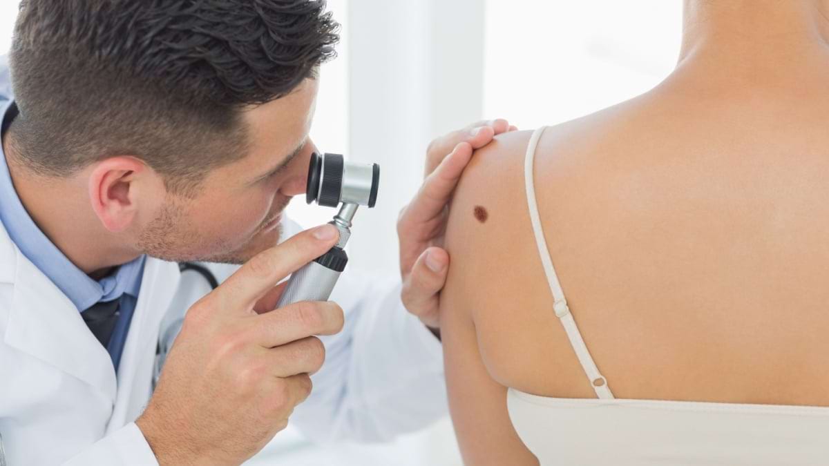 Melanomul - diagnostic, prevenire, tratament