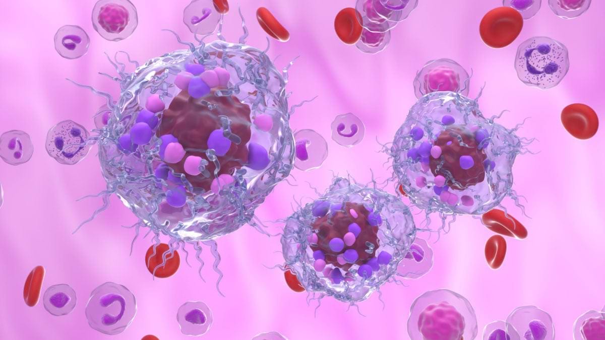 Tumorile neuroendocrine: diagnostic si tratament