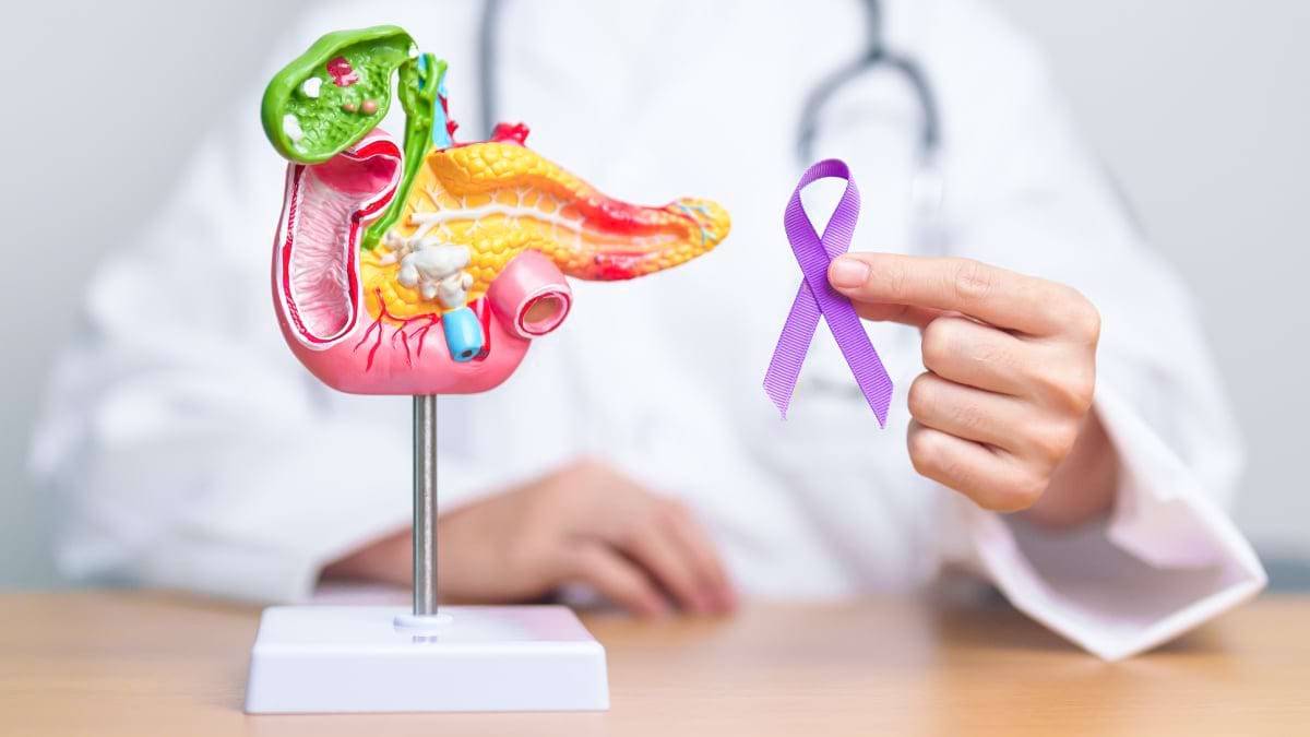 Cancerul de vezică biliară: simptome, diagnostic, tratament și post-tratament